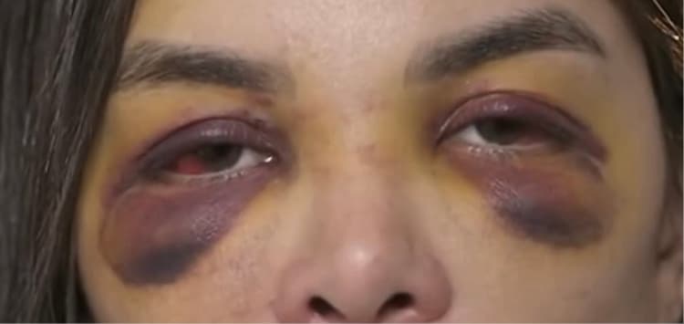 (Vídeo)O relato de uma dentista sobre as agressões cometidas pelo empresário, que começaram antes mesmo do casamento